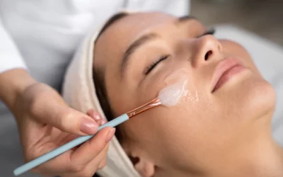 Professional chemical peel facial treatment at Ooh La La Med Spa