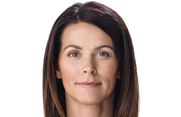 Juvederm Kelly (before)