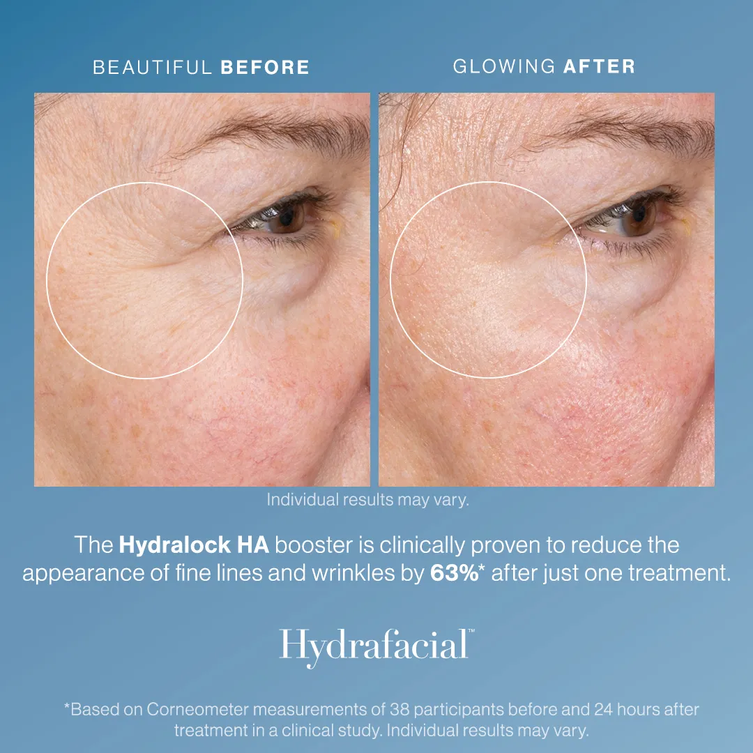 Hydralock HA booster - hydration results